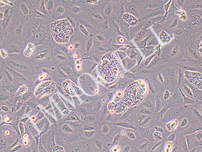 LCC人喉癌细胞（STR鉴定正确）