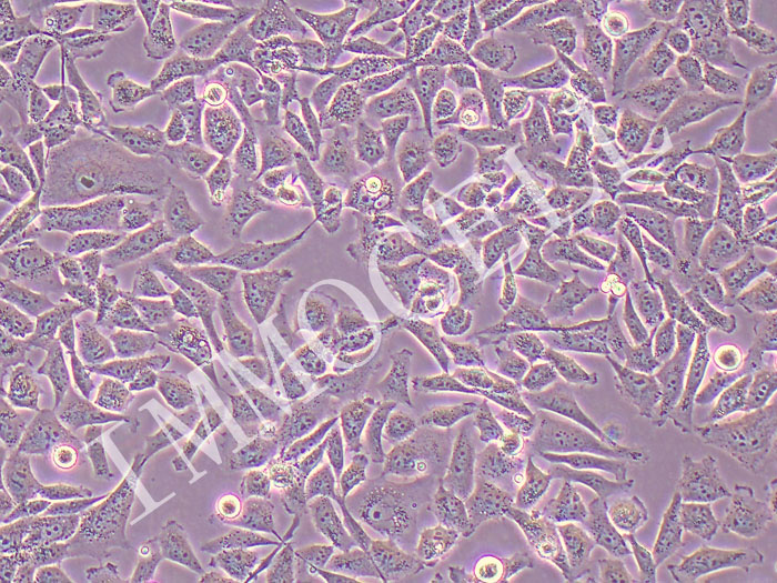 MO3.13人少突胶质细胞（STR鉴定正确）