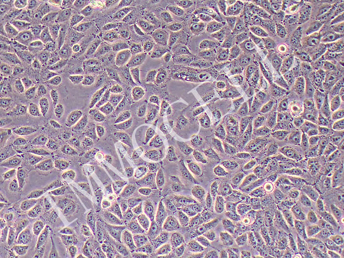 NCI-H1666 人肺支气管癌细胞（STR鉴定正确）