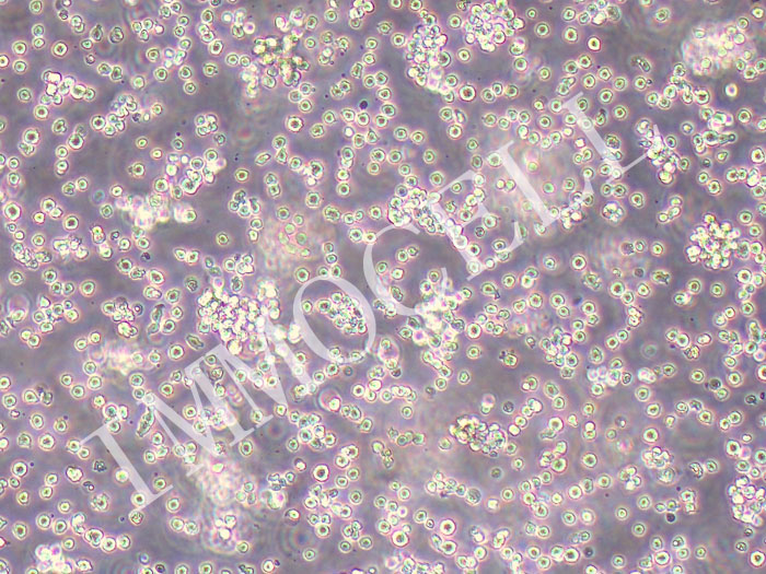 RI-1人B细胞淋巴瘤细胞系（STR鉴定正确）