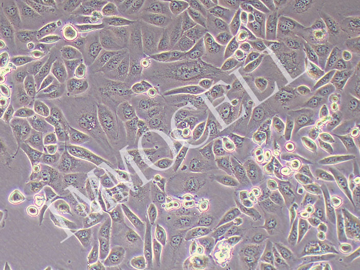SNGM人子宫内膜腺癌细胞（STR鉴定正确）