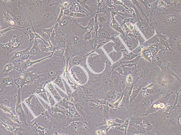 MDA-MB-157人乳腺癌细胞
