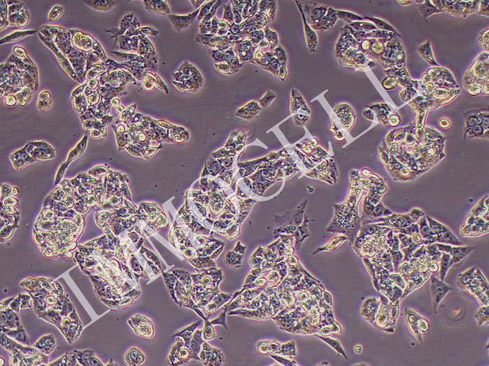 HepG2人肝癌细胞（STR鉴定正确）图片
