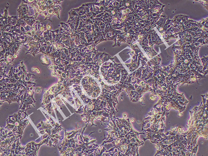 SW1463人结肠直肠腺癌细胞（STR鉴定正确）