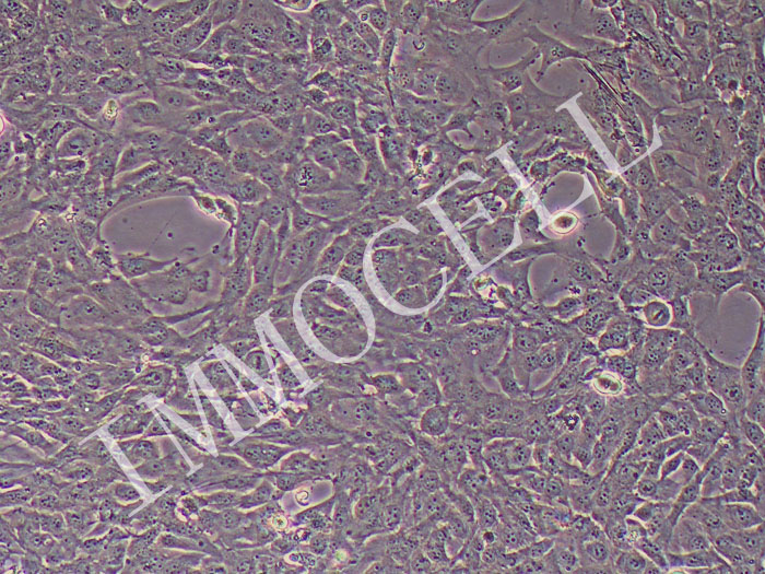 12Z人子宫内膜异位细胞