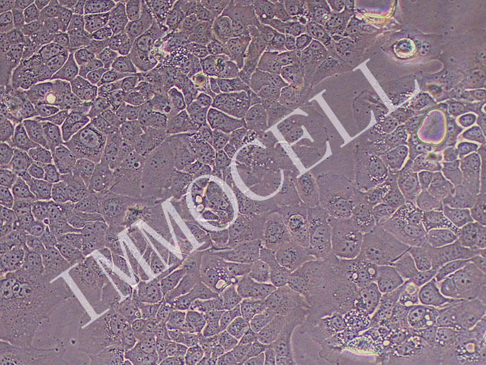 HDQ-P1人乳腺癌细胞（STR鉴定正确）