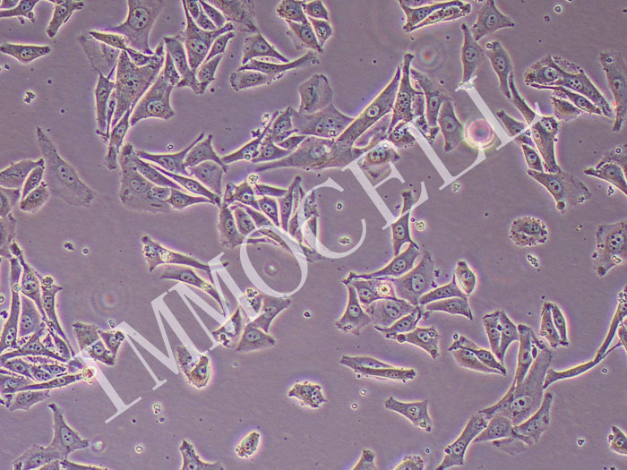 HMY-1人恶性黑色素瘤细胞（STR鉴定正确）