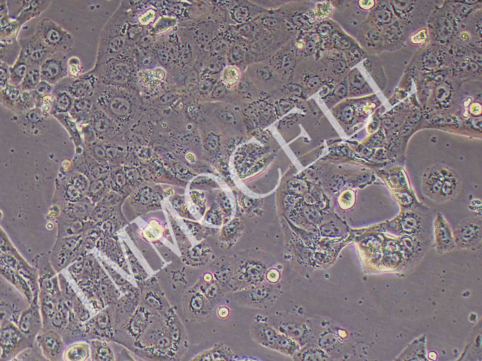 NCI-H820人肺乳头状腺癌细胞（STR鉴定正确）