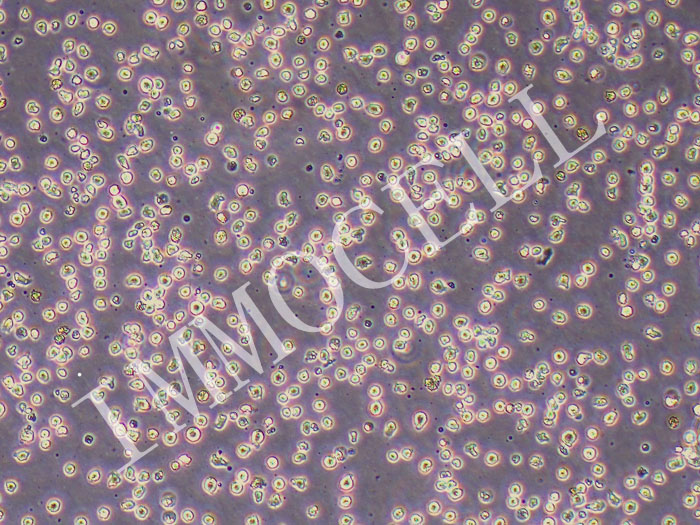 RS4:11人急性淋巴细胞白血病（STR鉴定正确）