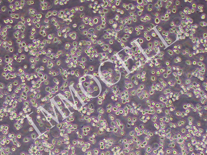 SKNO-1人急性髓系白血病细胞（STR鉴定正确）