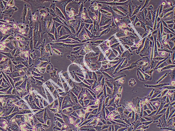 SNU-668 人胃癌细胞（STR鉴定正确）