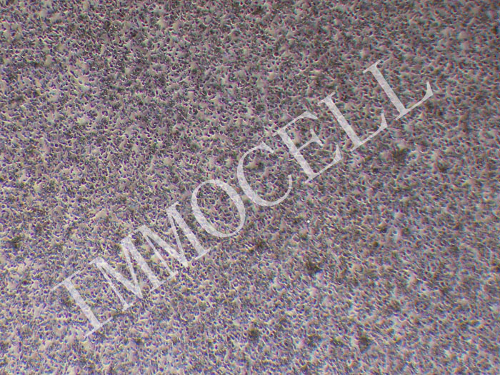 SU-DHL-1人间变性大细胞淋巴瘤细胞