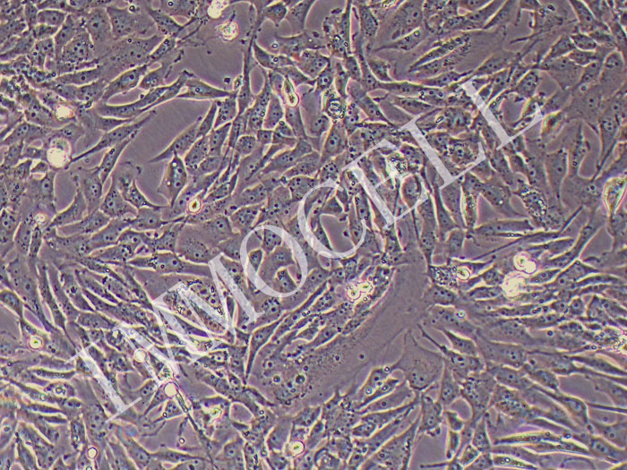 SW1783人间变性星形细胞瘤细胞