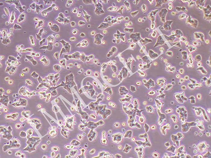 MIN6小鼠胰岛β细胞（STR鉴定正确）
