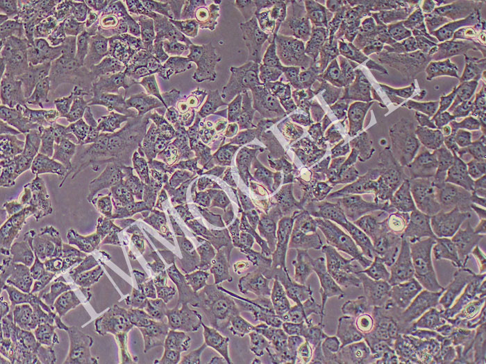 CHL-1人黑色素瘤细胞（STR鉴定正确）