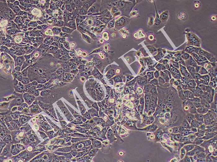 OE-33人食管腺癌（STR鉴定正确）