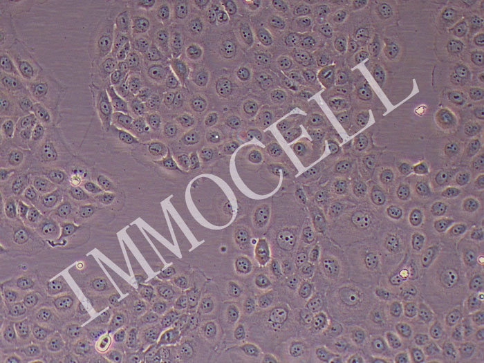 WSU-HN6 人舌鳞癌细胞（STR鉴定正确）