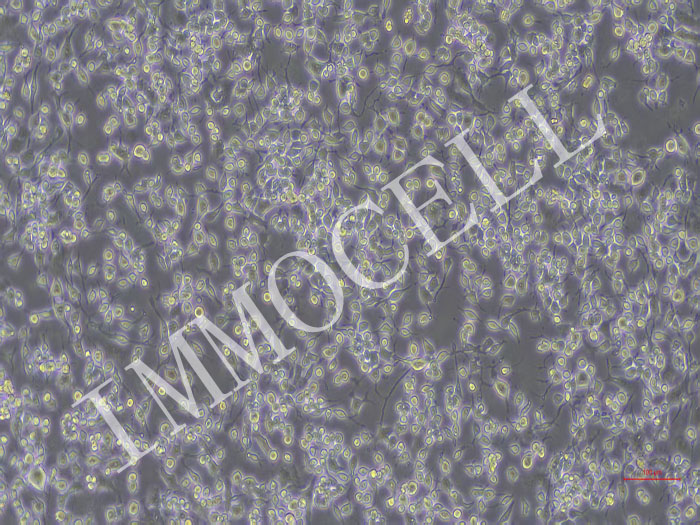 LN229-NLUC-bsd人大脑神经母瘤细胞(NLUC标记）