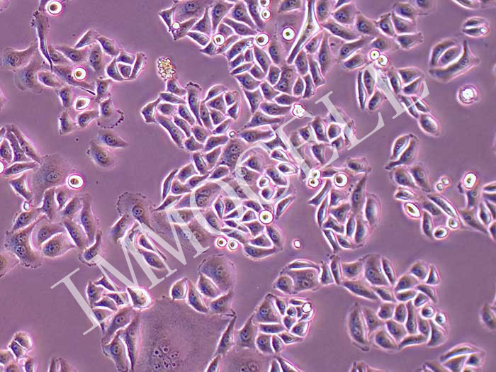 HELA人宫颈癌细胞（STR鉴定正确）