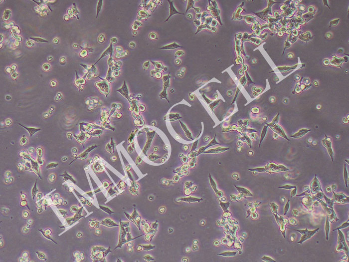 D341 Med人脑髓母细胞瘤细胞（STR鉴定正确）