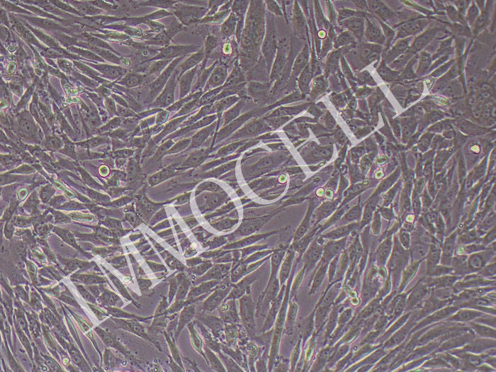 HS683人脑胶质瘤细胞（STR鉴定正确）