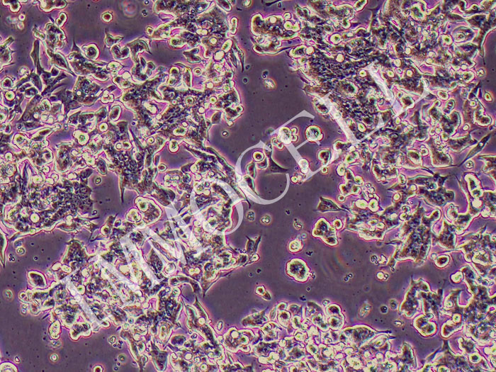 IM95m人胃癌细胞（STR鉴定正确）