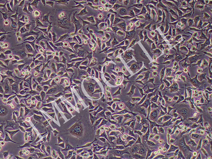 KYSE-180人食管鳞状细胞癌细胞（STR鉴定正确）
