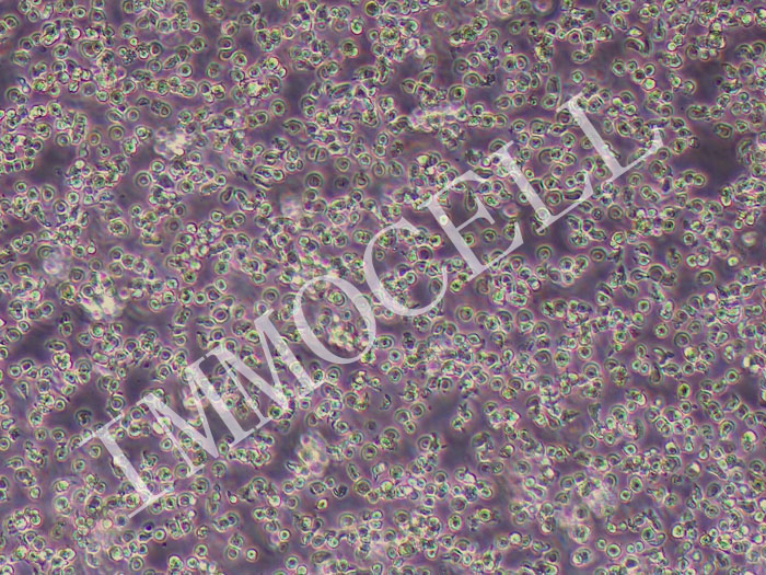 P815小鼠肥大细胞瘤细胞（STR鉴定正确）