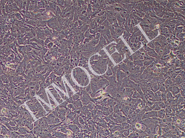 HBVP-SV40T-hTERT人脑血管周细胞永生化