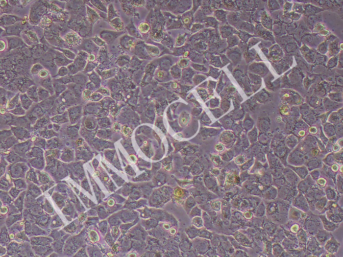 hcc1569人乳腺癌细胞