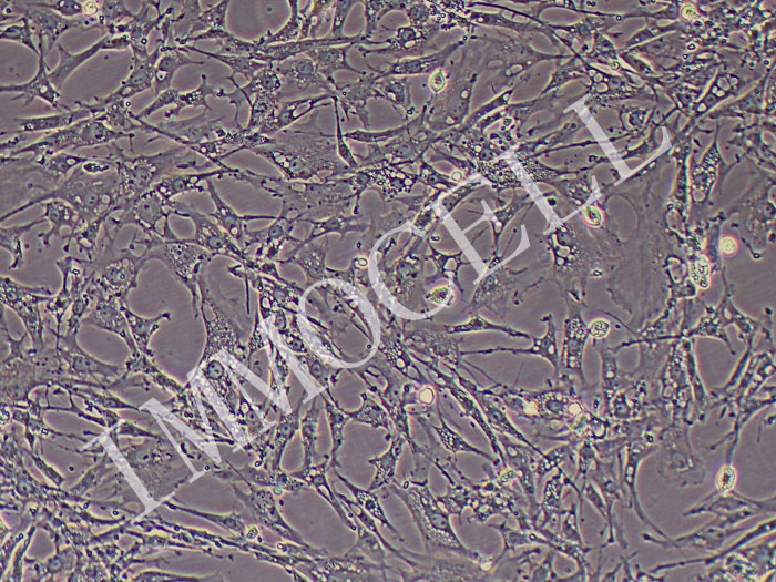 鸡胚成纤维细胞永生化