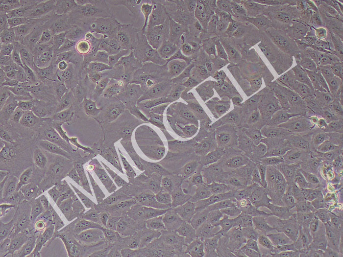人Ⅱ型肺泡上皮细胞永生化