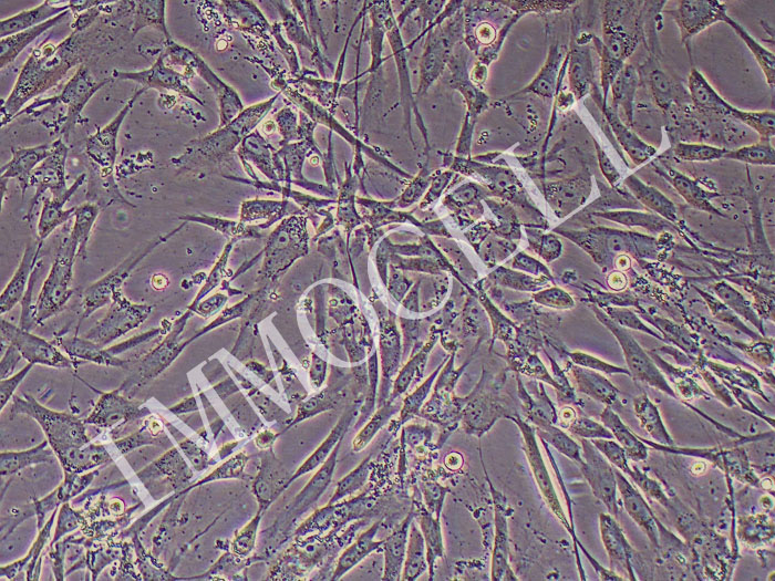 人脂肪干细胞永生化