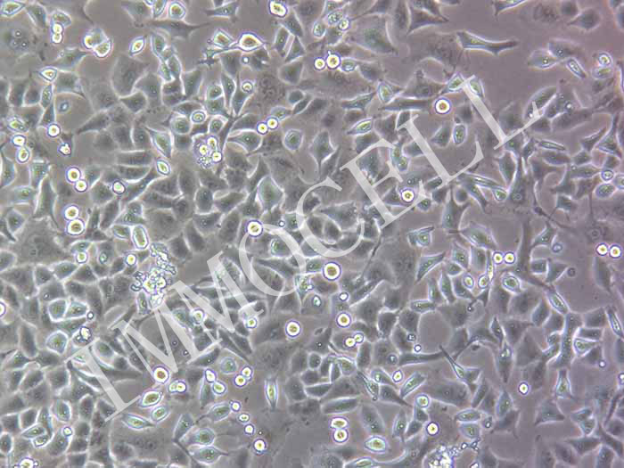 PANC-1人胰腺癌细胞（STR鉴定正确）