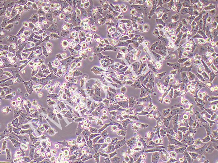 PATU 8988S人胰腺癌细胞
