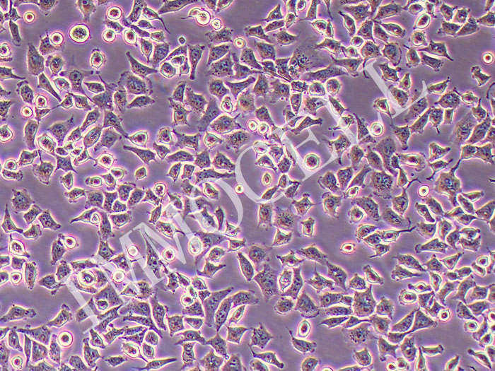 RD人恶性胚胎横纹肌瘤细胞（STR鉴定正确）