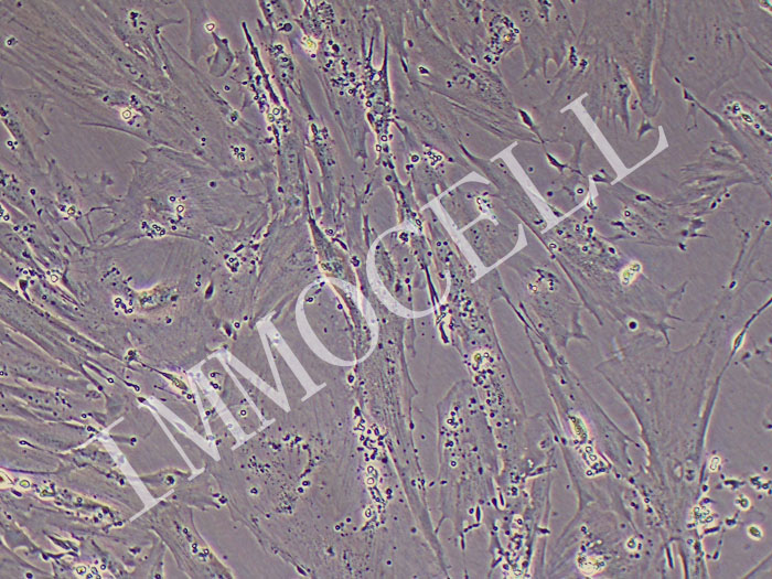 iheESCs永生化人子宫内膜在位基质细胞（暂不提供）