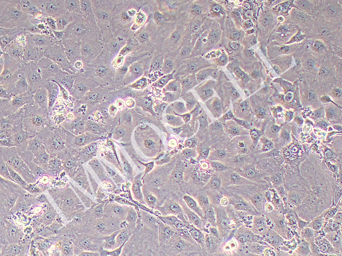 HK-2人肾皮质近曲小管上皮细胞（STR鉴定正确）