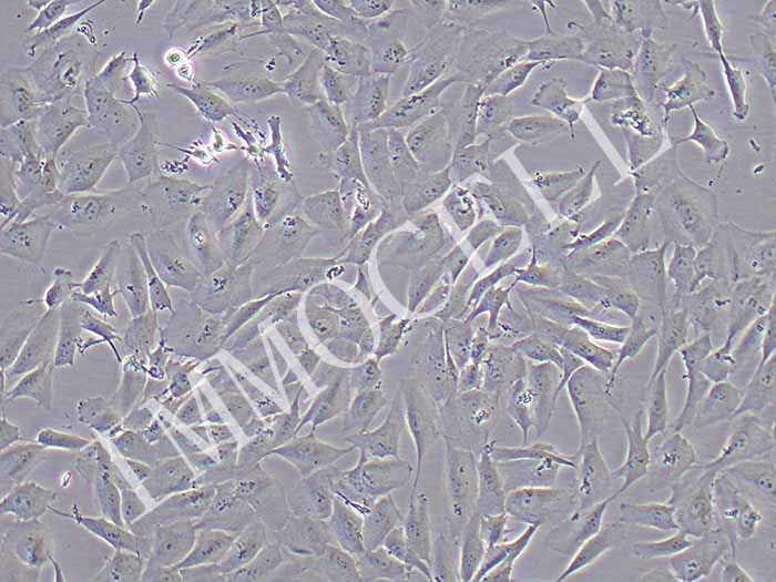 MCF-10A人乳腺上皮细胞（STR鉴定正确）