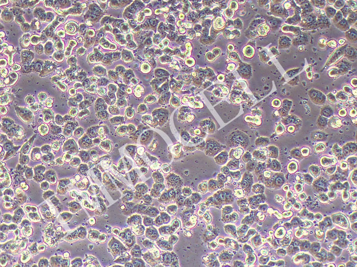 MDA-MB-468人乳腺癌细胞（STR鉴定正确）