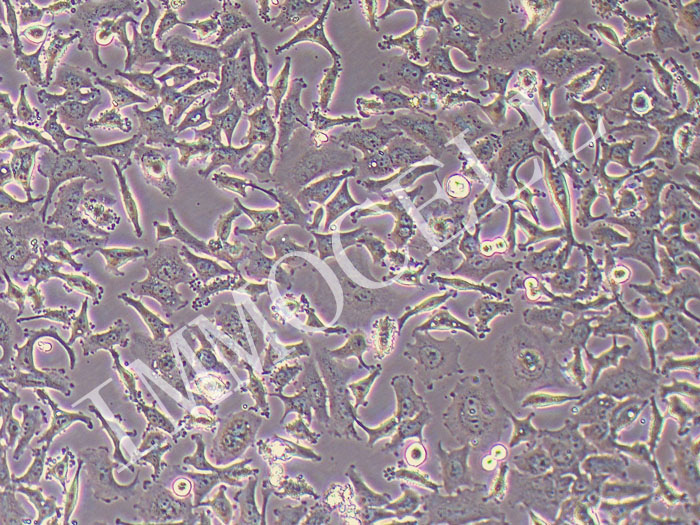 HCC1954人乳腺导管癌细胞（STR鉴定正确）