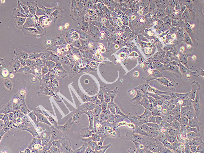 MH7A关节炎成纤维细胞（STR鉴定正确）