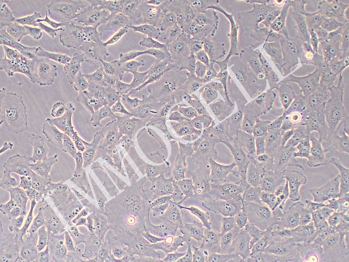 SF-268人神经癌细胞株（STR鉴定正确）