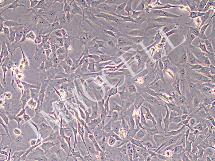 Calu-1人肺癌细胞（STR鉴定正确）