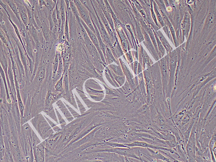 HSF人皮肤成纤维细胞（免疫荧光鉴定）图片