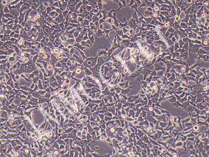 KYSE-450人食管鳞癌细胞（STR鉴定正确）