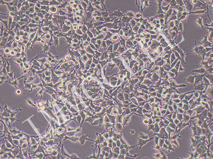 NCI-H3122人非小细胞肺癌细胞（STR鉴定正确）