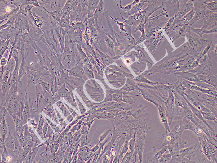 人髓核细胞永生化细胞（免疫荧光鉴定）