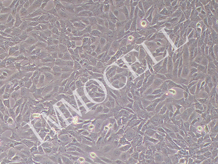 MPC-5小鼠肾足细胞（STR鉴定正确）
