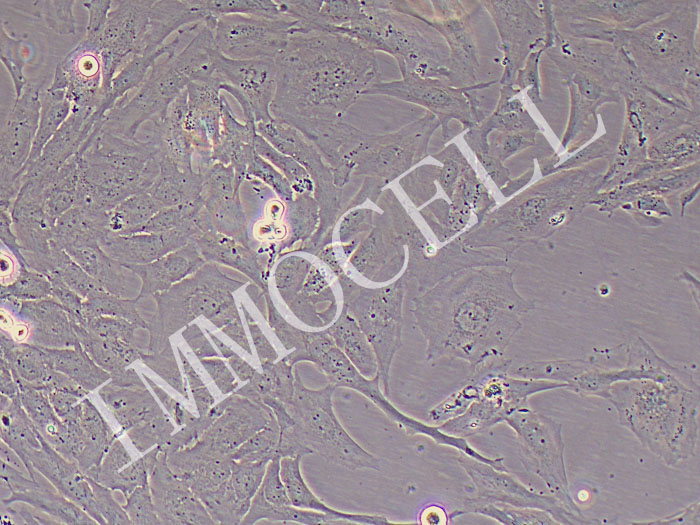NCI-H196人小细胞肺癌细胞（STR鉴定正确）